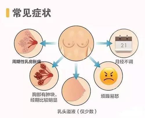 中醫角度認識乳腺增生