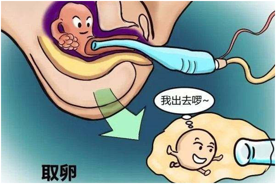 国外第三代试管婴儿（滔滔顾问：很多人都忽略了大龄做试管婴儿的这些好处）