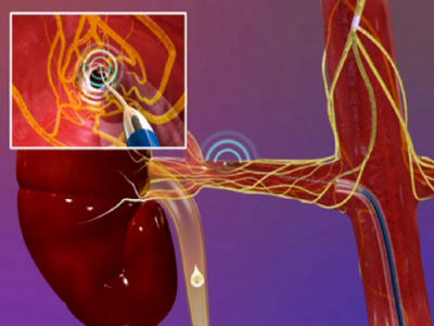 【中医心脑血管病】中医对心脑血管疾病这样治!__凤凰网