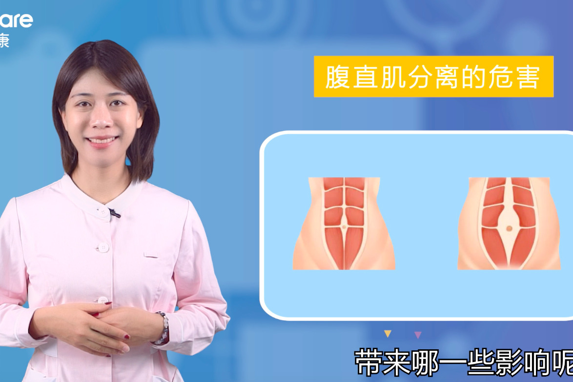 产后腹直肌分离会带来的影响4点危害不容忽视