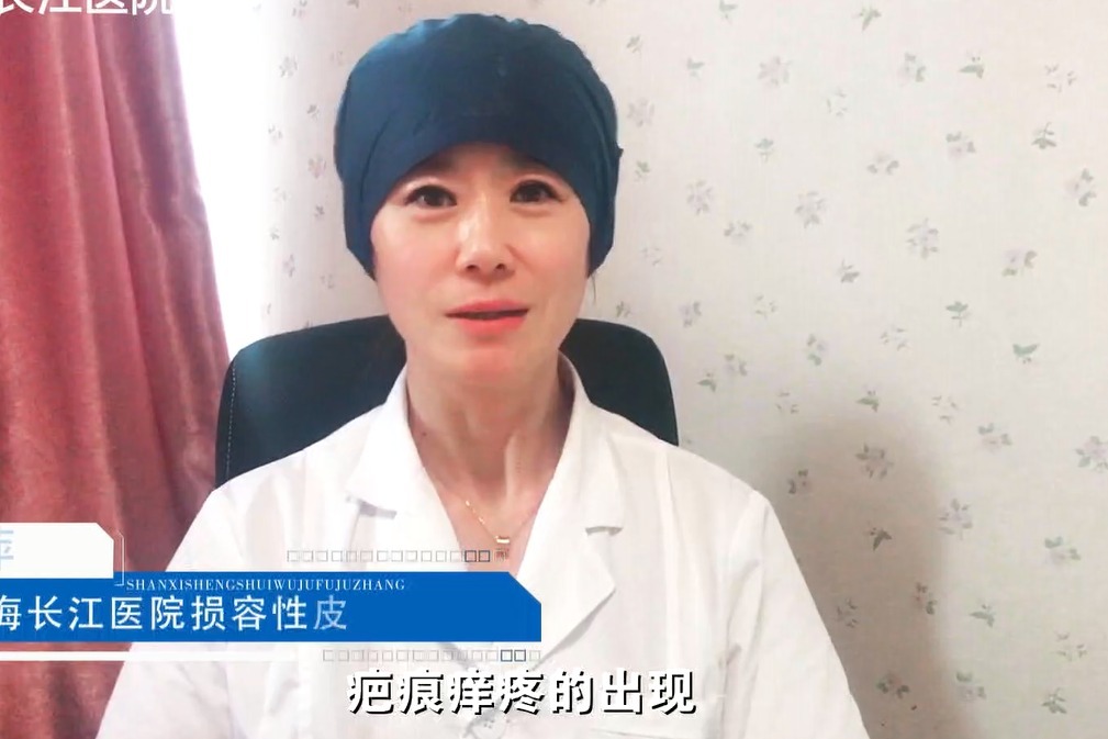 上海长江疤痕医院肖萍科普:疤痕痒疼怎么回事