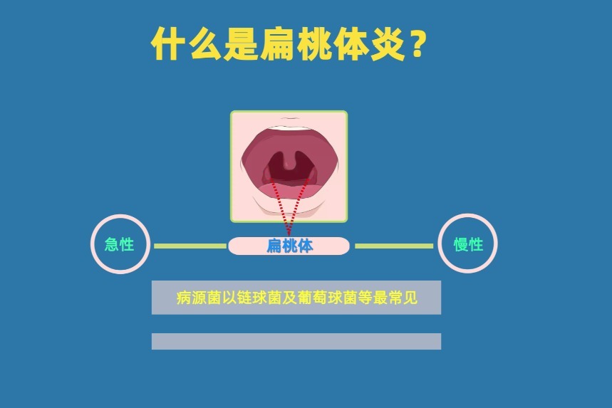 什么是扁桃体炎，扁桃体炎有什么危害？温州建国医院耳鼻喉科解答