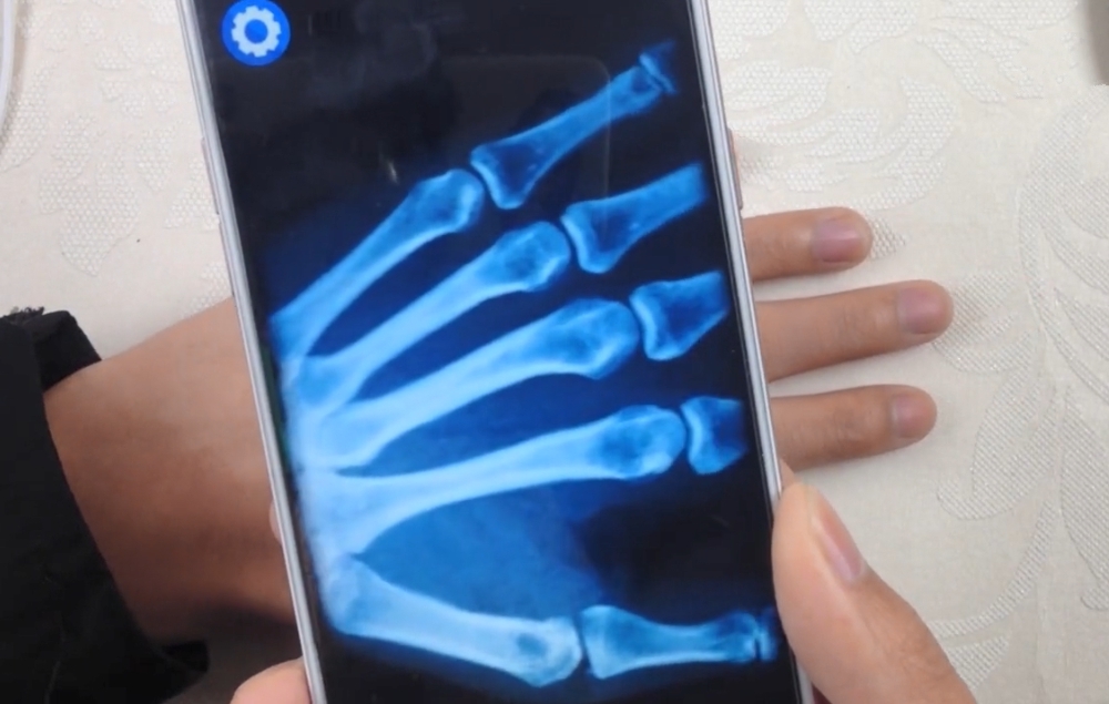 手机这样设置下，秒变“扫描透视仪”，连手掌骨骼都能看清楚