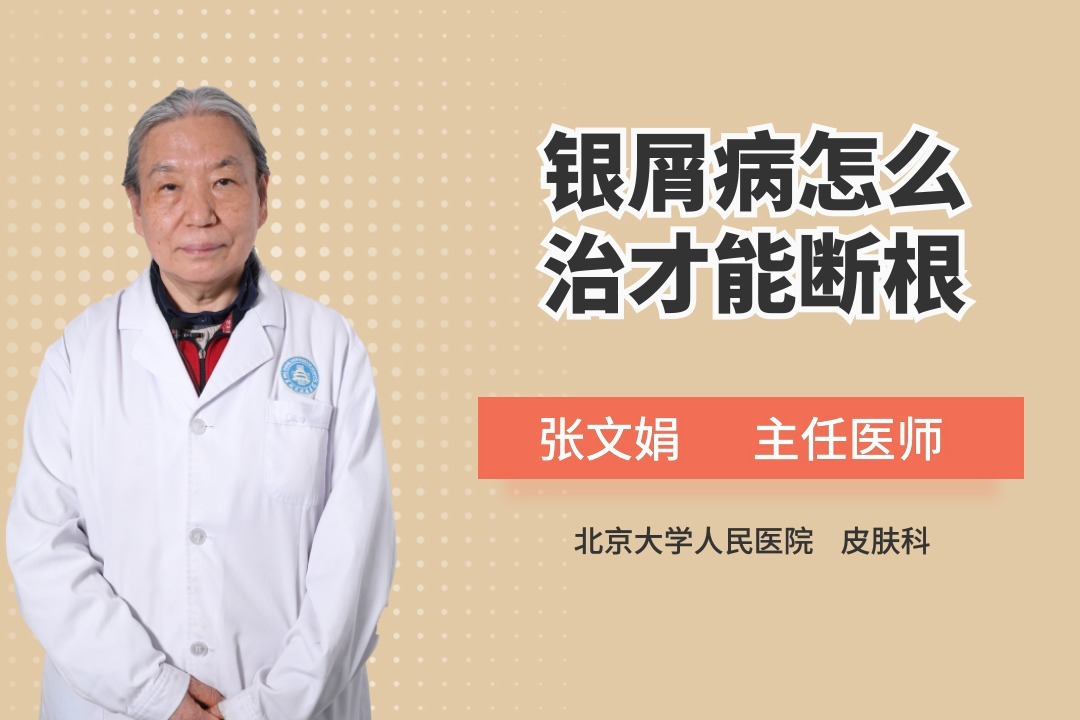 银屑病,怎么治疗,能断根吗