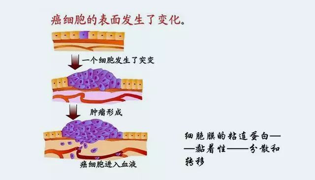 为什么肿瘤有分高分化,中分化和低分化?不同分化有什么区别?