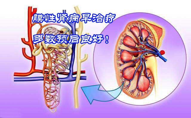 腎病專家楊彥芳:膜性腎病早治療多數預後良好,很少發展到尿毒症