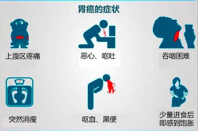 关注|没感觉到不适症状,检查为什么会得胃癌?