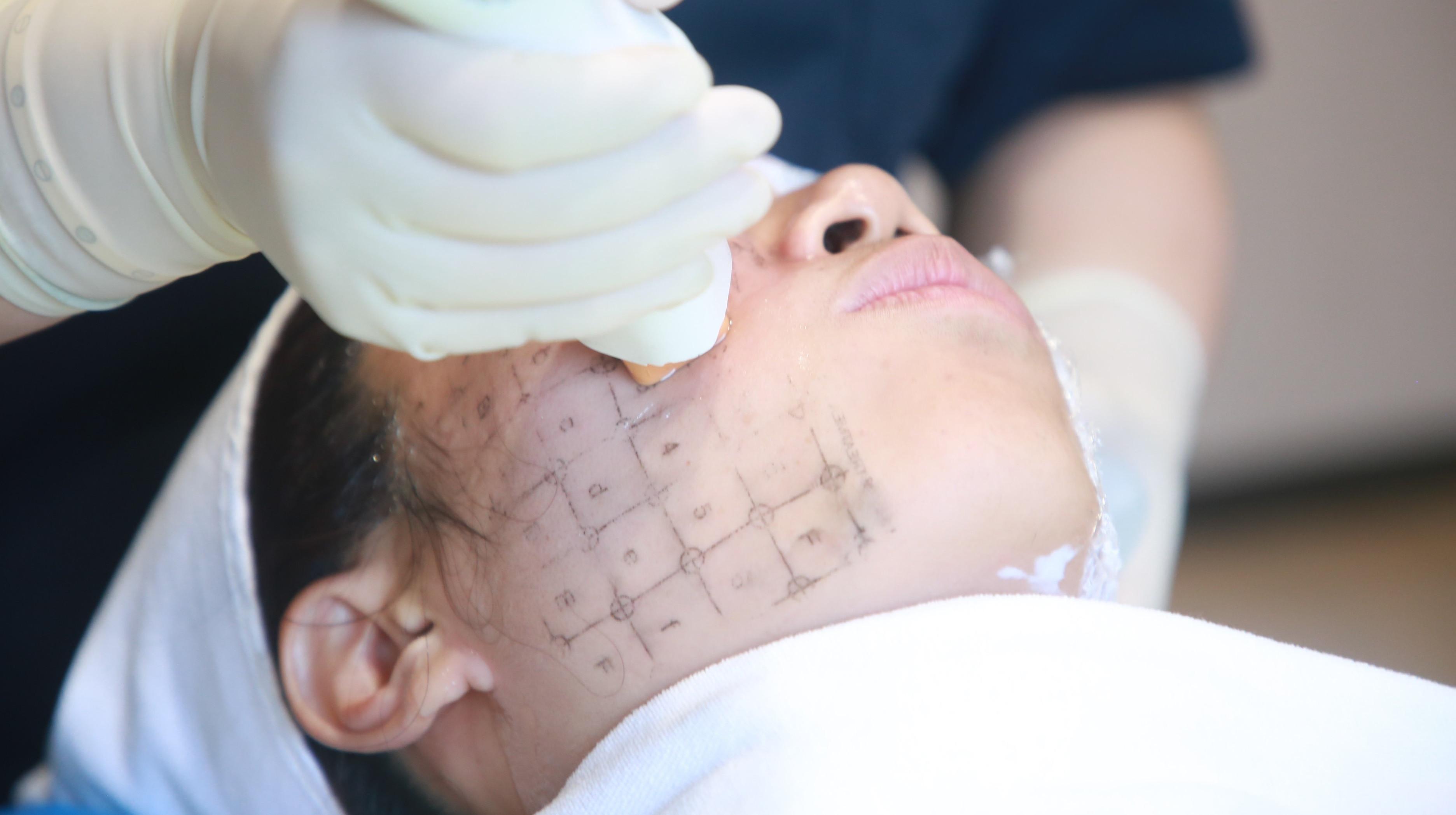 热玛吉到底值不值得做?