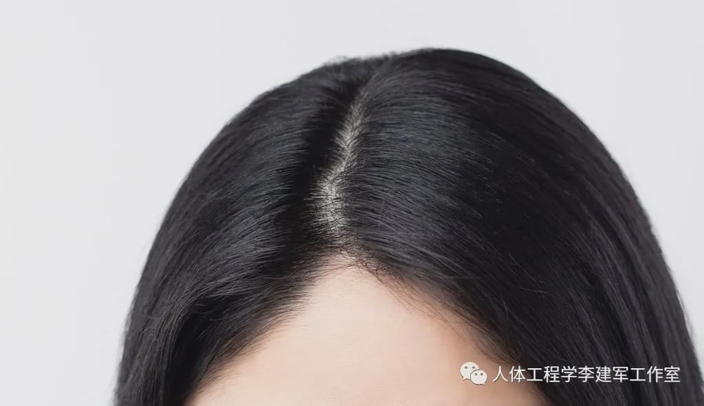 做个小检测,看看自己头皮是否健康?