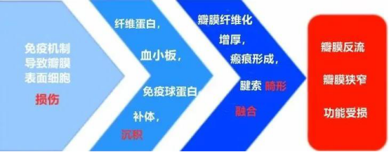 5, libman-sacks心内膜炎