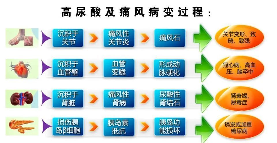 这些痛风的知识,你需要有所了解!