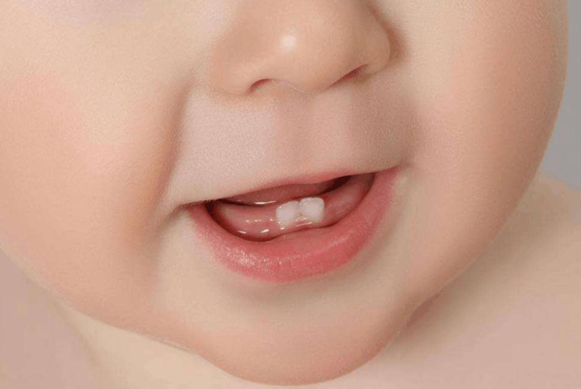 乳牙保存有其特定的方式,家长自己保存并不是一种科学方法