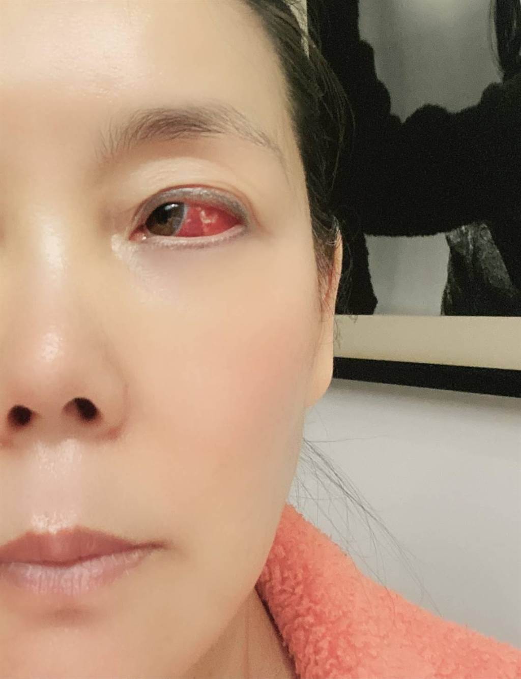 辛晓琪惊传眼睛爆血压力大,疑似身体出状况_品推资讯