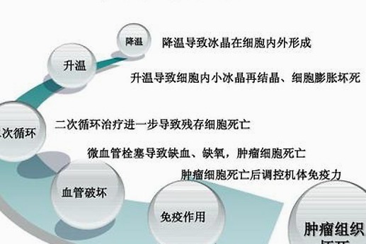 海杰亚康博刀-由我国科学家自主研制肿瘤微创治疗设备_凤凰网