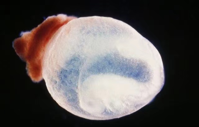 人流胚胎绒毛图片图片