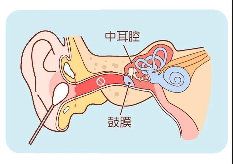 重慶年輕人助聽器:耳朵經常容易進水,怎麼辦?