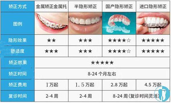 牙齿矫正常见类型有金属矫正,半隐形矫正,全隐形矫正,选择虽多,但是