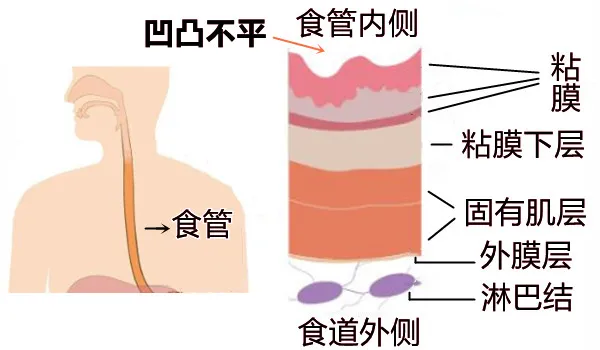 大白话说中医第一百五十期|口腔食管通胃囊,贲门把关做安防__凤凰网