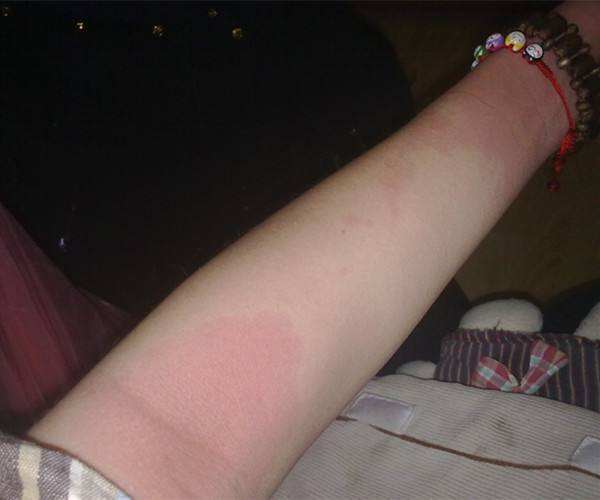 喝酒后身体出现这几种变化需要警惕身体在告诉你赶紧戒酒