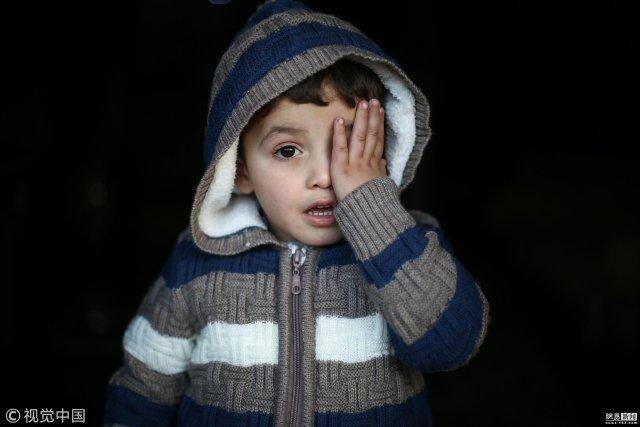 叙利亚战争群像:那些失去眼睛的孩子