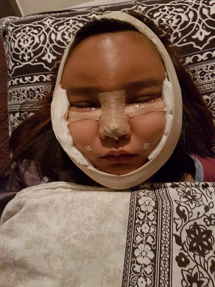 泰国网红4姐妹整容后绑绷带上街吓坏网友