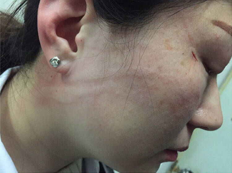 "我要毁你的容,把你的脸撕碎"