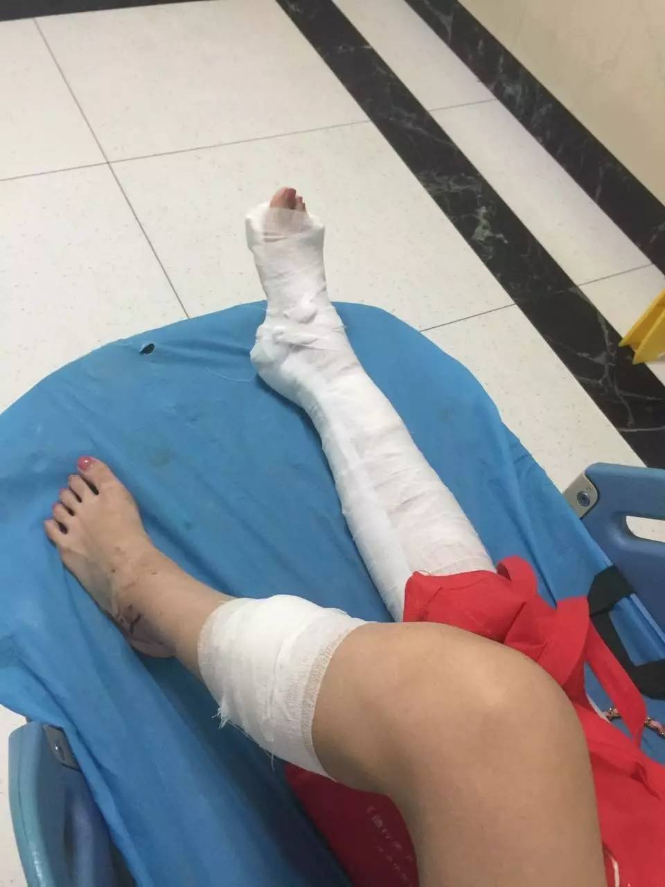 当刘女士睁开眼,腿部已经血肉模糊,这时打人的两名陌生男子已经逃离.