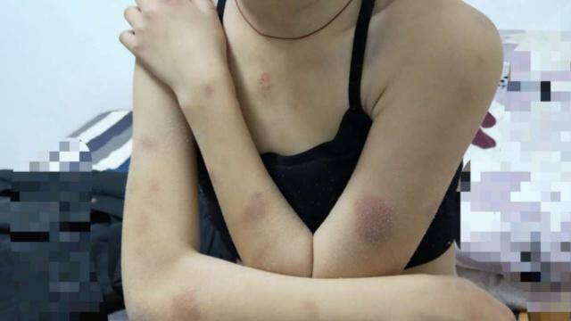 女生受校园欺凌 7名打人者未满14周岁