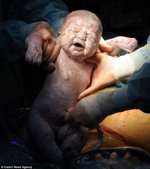 婴儿出生瞬间照片