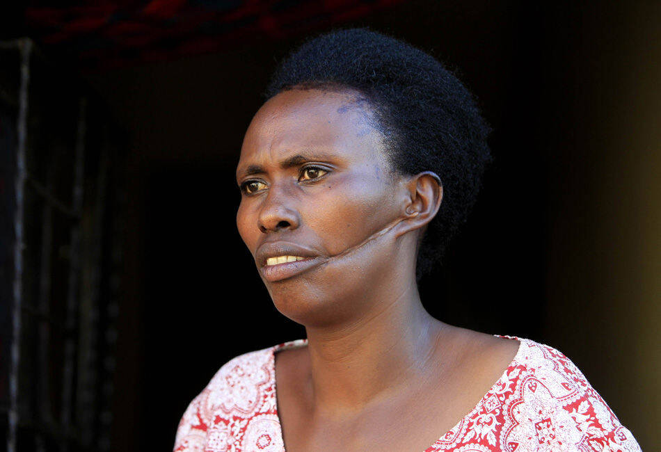 1/16 42岁的alphonsine mukamfizi,她从三次攻击中活了下来,为了生存