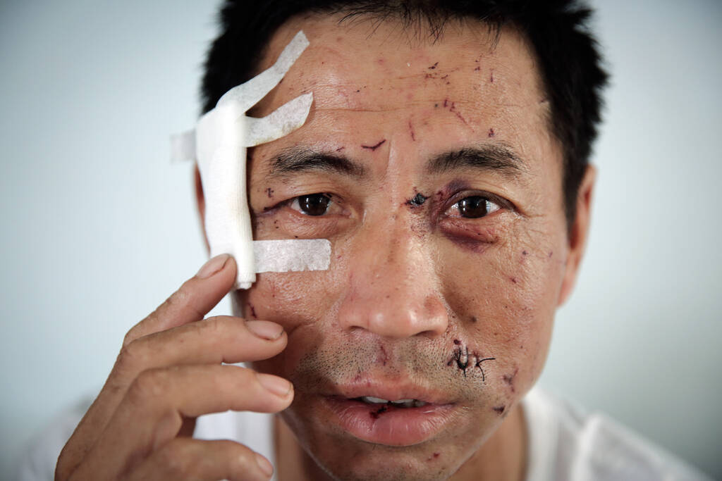 爆炸亲历者讲述生死瞬间:能活着就不错了