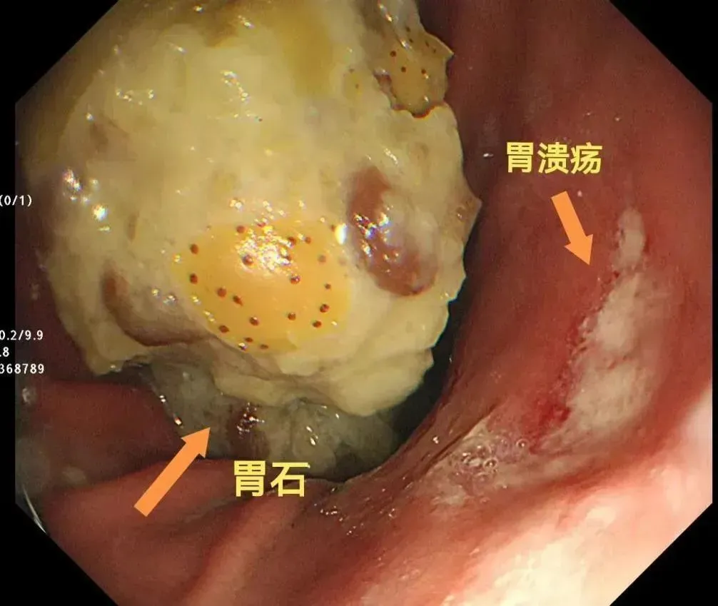 ĳʳôɽ髺θʯ