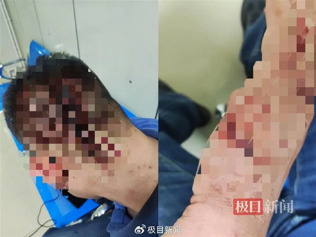 男子称吐槽卤肉难吃遭殴打，店主：他碰瓷，打不过我被“反杀”