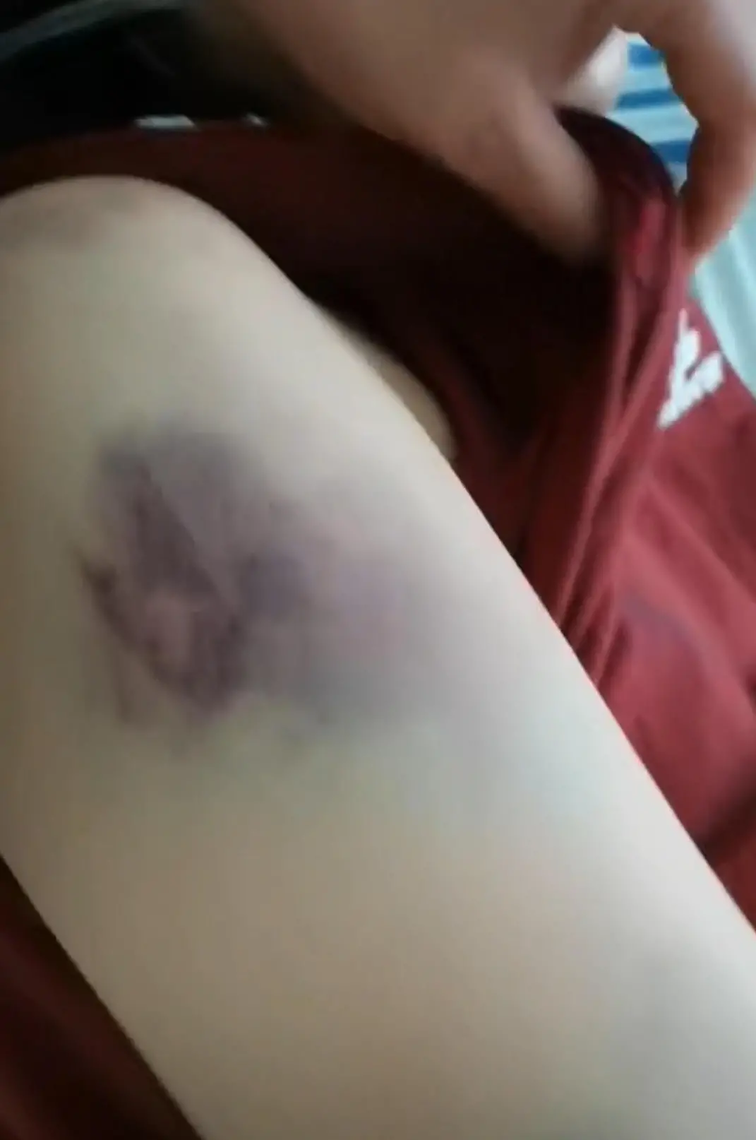 ▲曹某某身上的傷