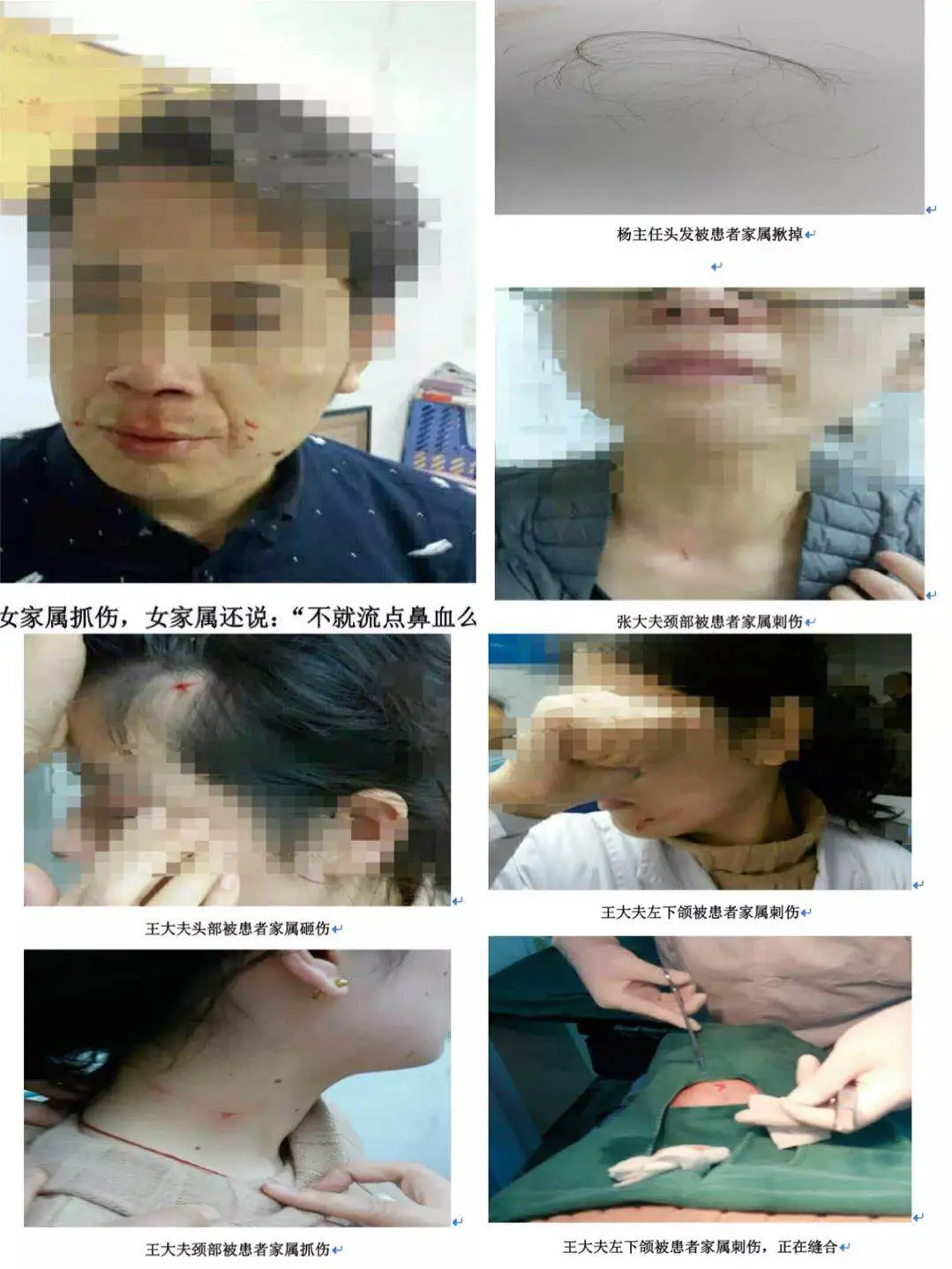 五星级酒店的一盘鱼香肉丝，值得思考.....-酒店各种鱼的做法