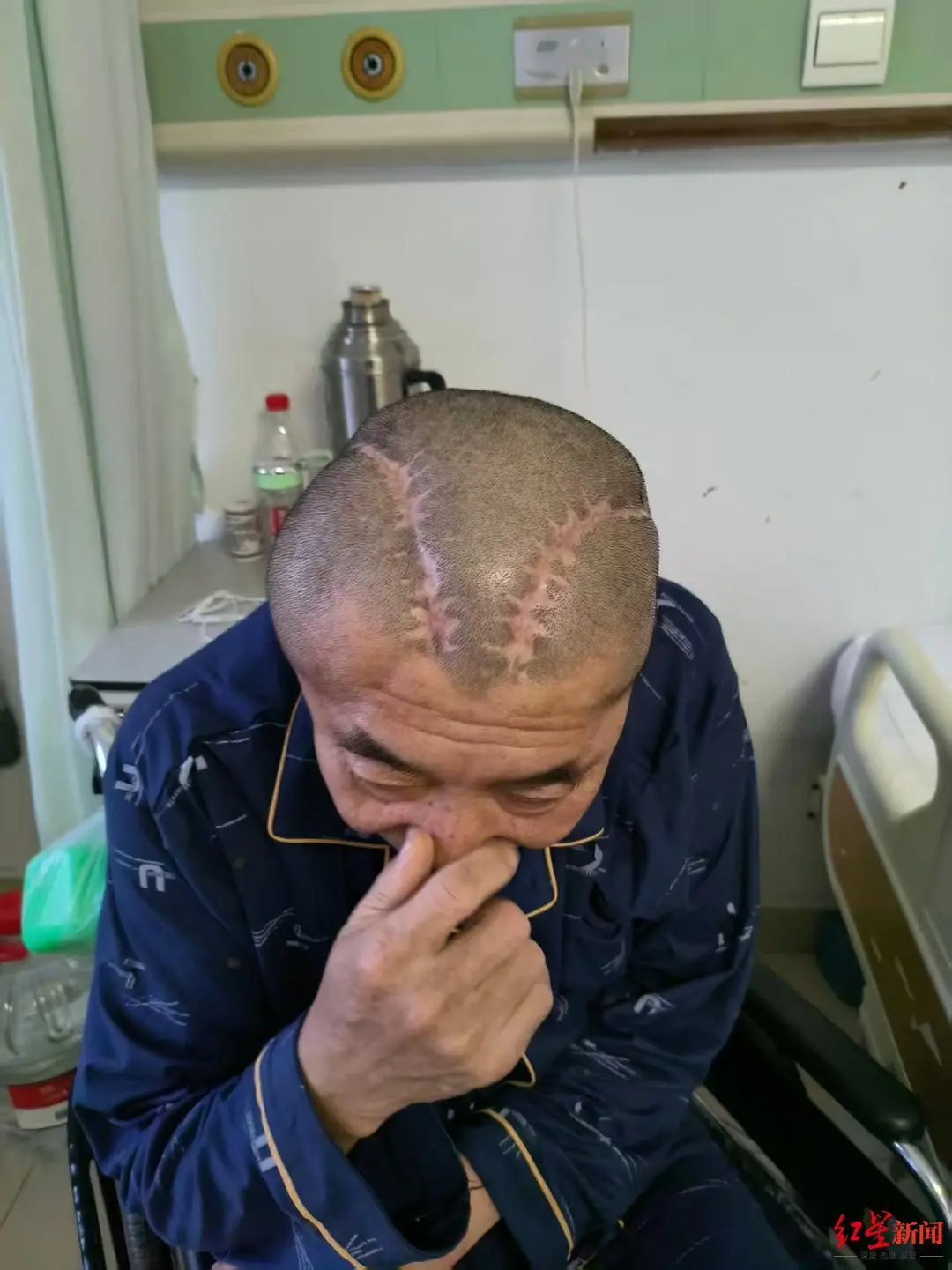 ▲术后的王先生