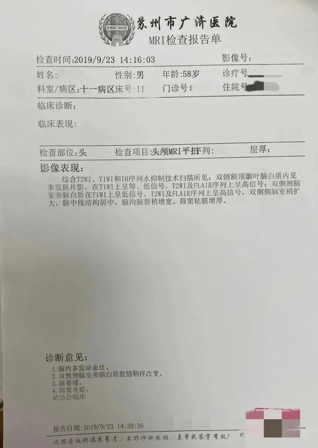 ■ 图 /爸爸的核磁共振检查结果，显示大脑已经发生病变