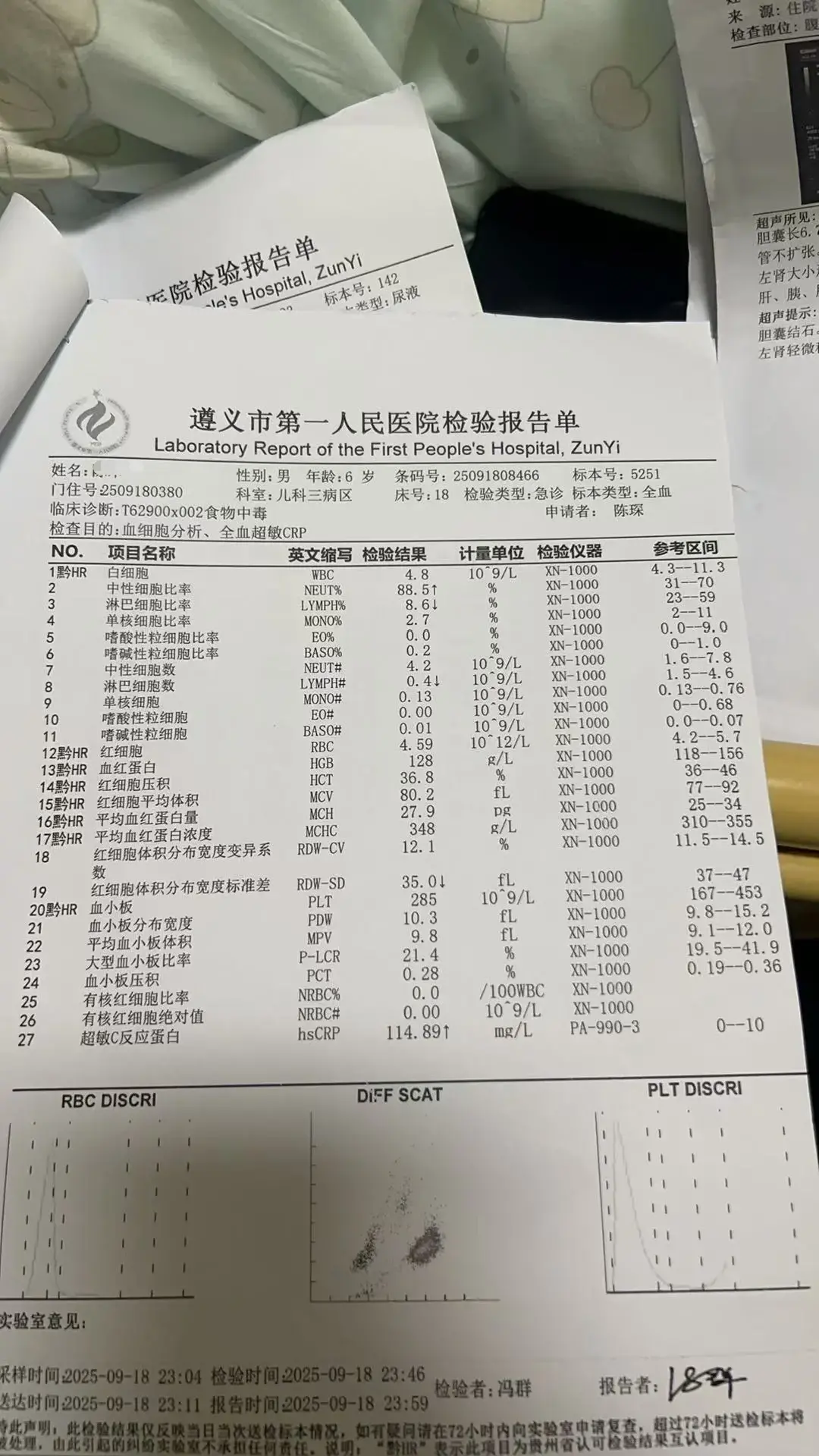 官方再通报贵州习水食物中毒:排除人为投毒可能