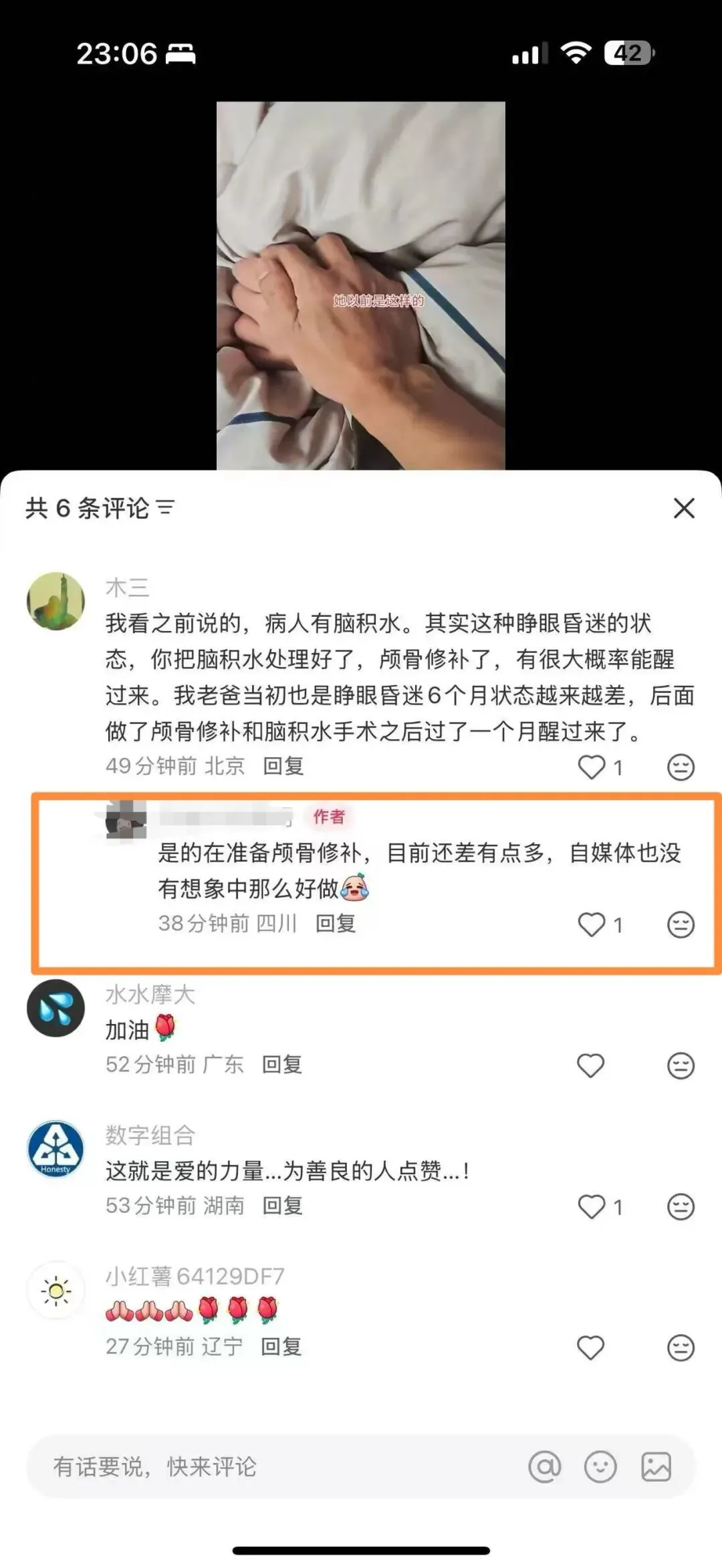 胡亮在评论区解释手术的问题。