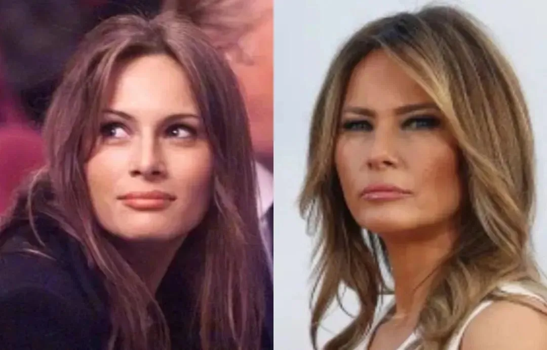 第一夫人Melania Trump前后对比/图源:VOGUE中国