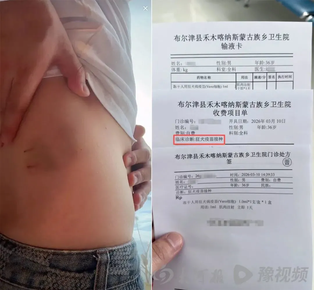 刘先生展示身上的伤口