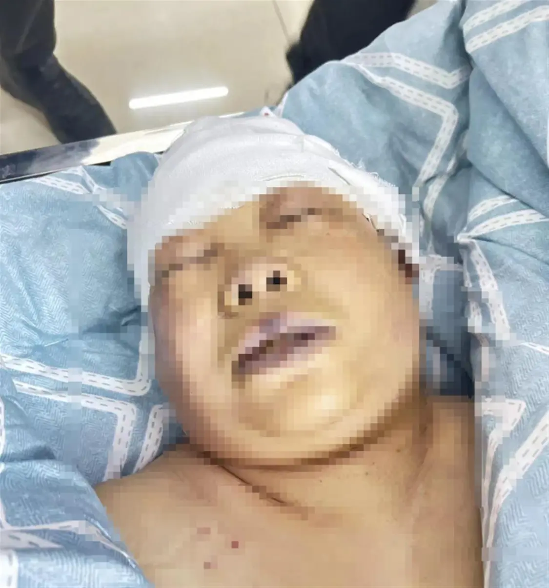 黄女士的婆婆被袭身亡(图片来源:网络)