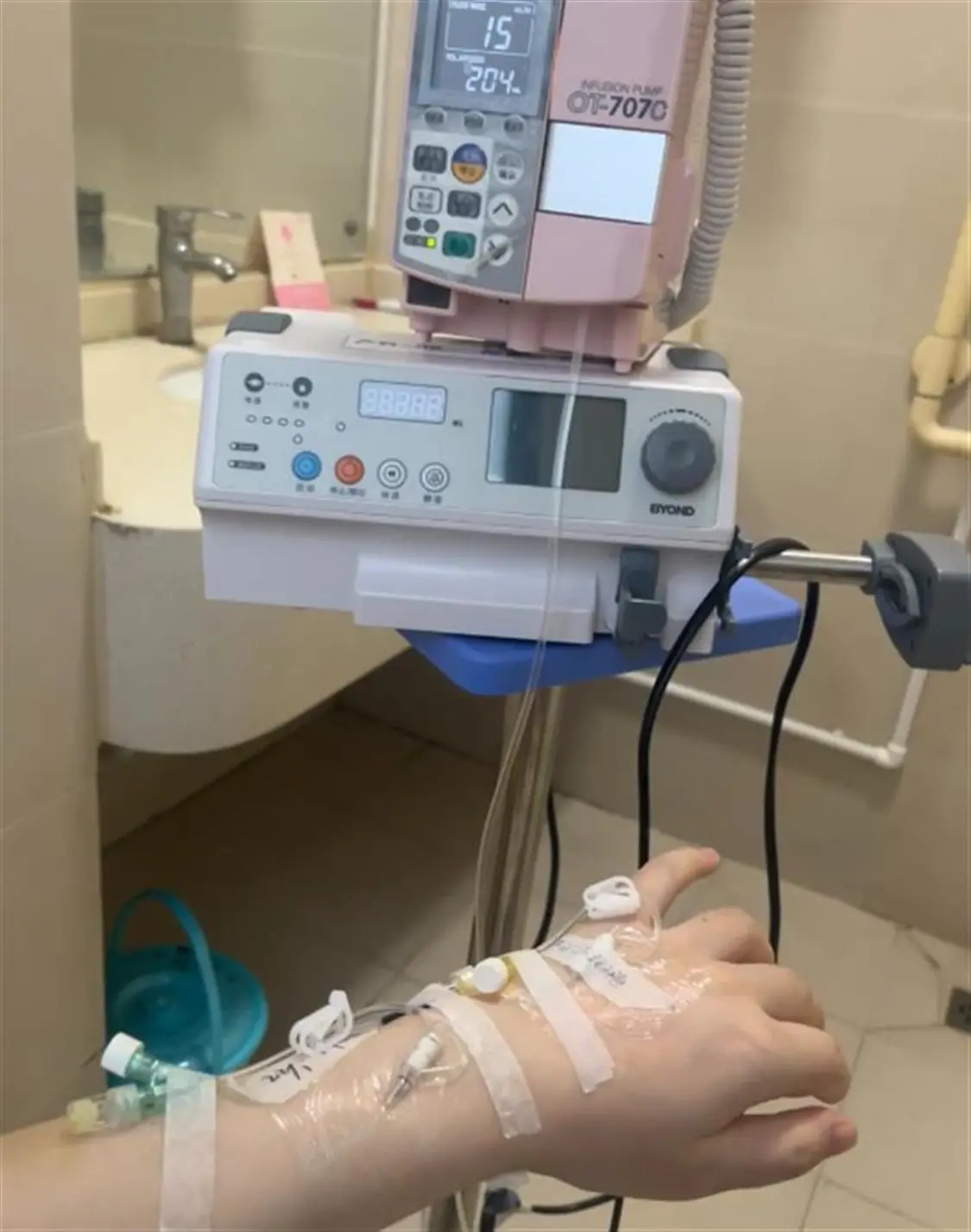 孕妇称在动车上被行李箱砸中腹部，孩子早产离世