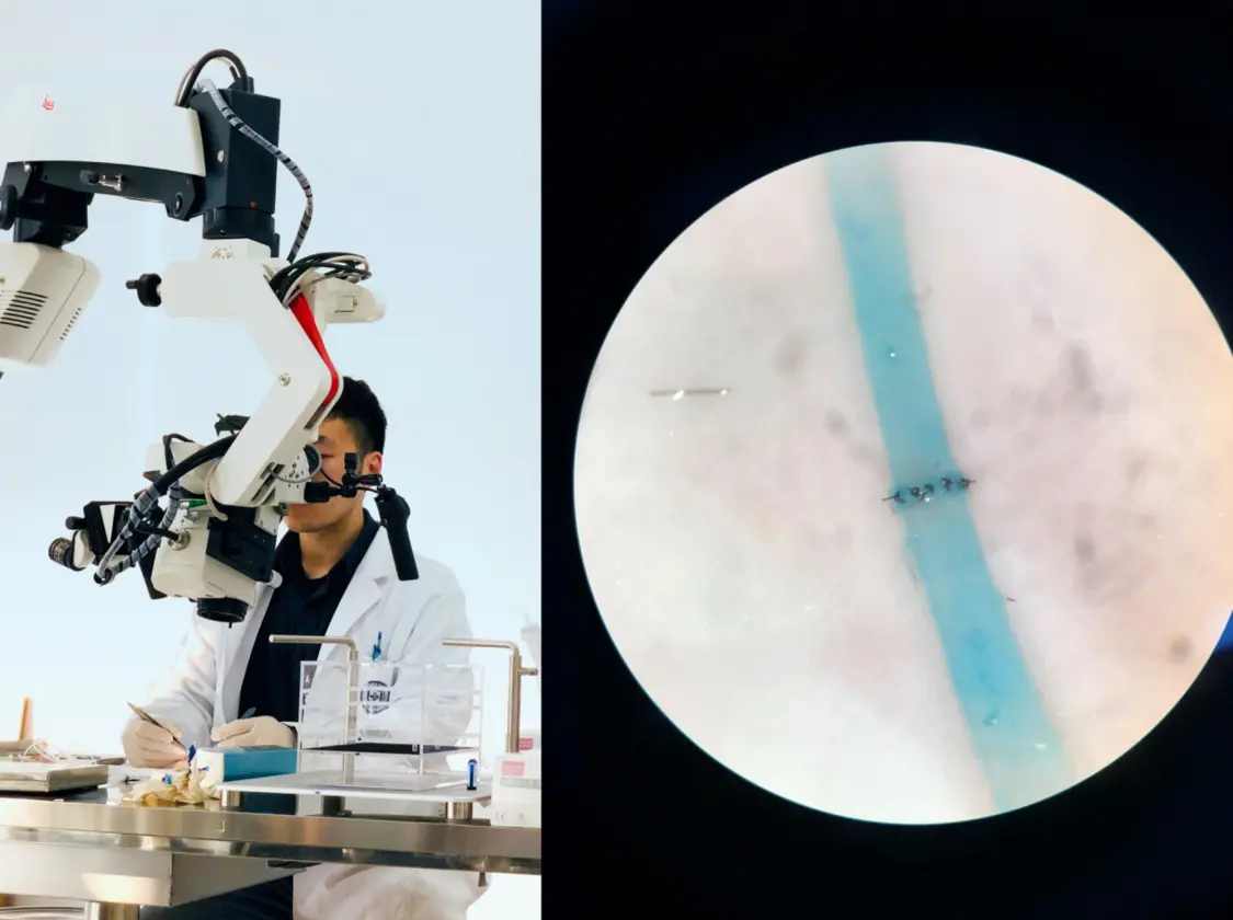 2018年《显微神经外科血管吻合》课程中何世豪在显微镜下放大20倍后对1毫米的鸡翅血管缝合练习。