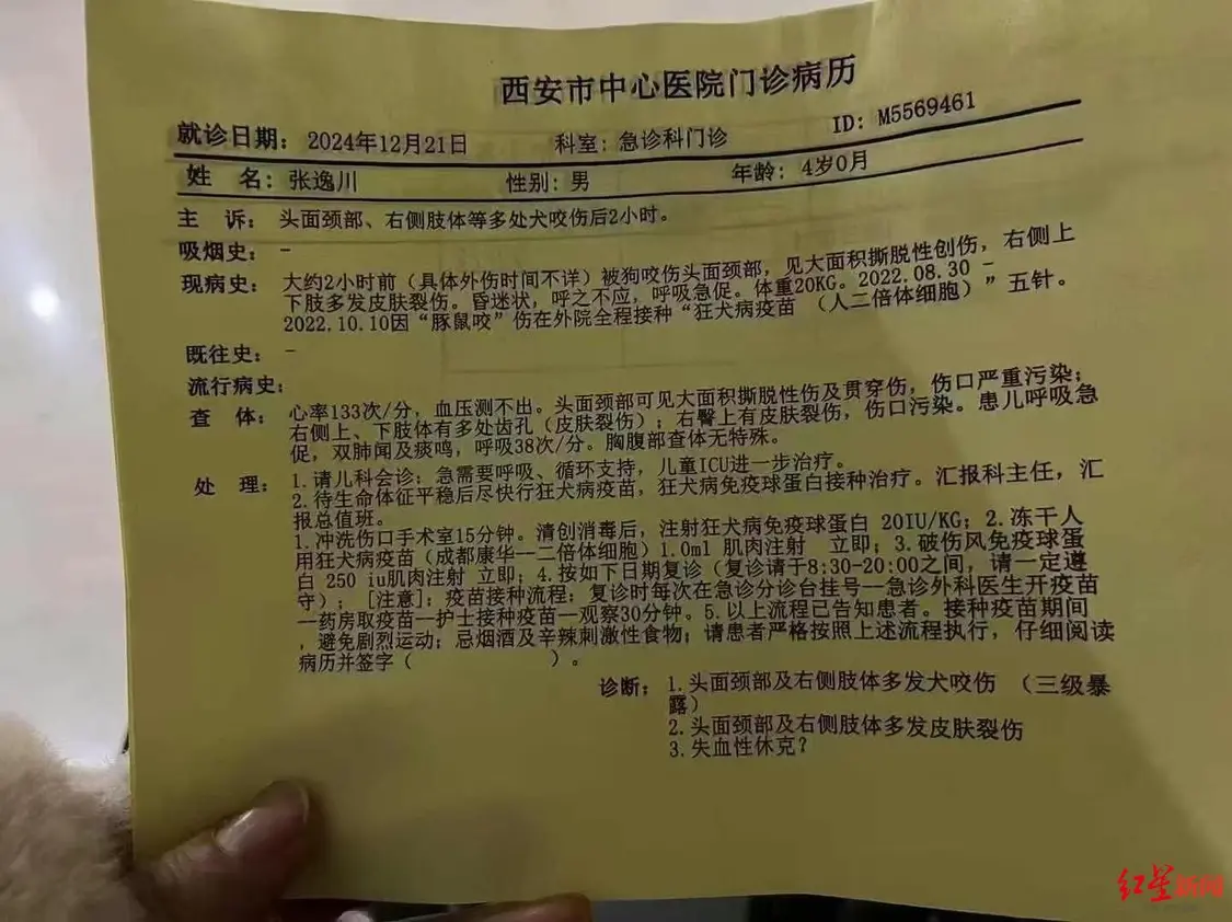 4岁男童遭恶犬袭击,致脸部大面积创伤,仍ICU昏迷