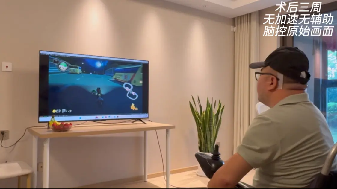 中国成功开展首例侵入式脑机接口临床试验