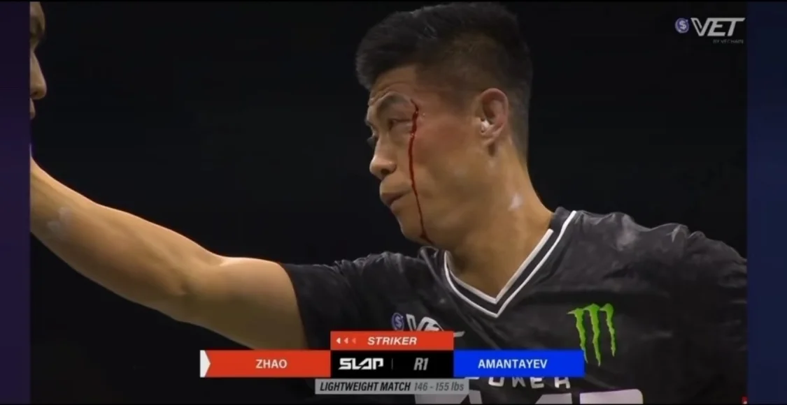 扇耳光大賽趙鴻剛:練了兩年通背拳 沒想到打成這樣