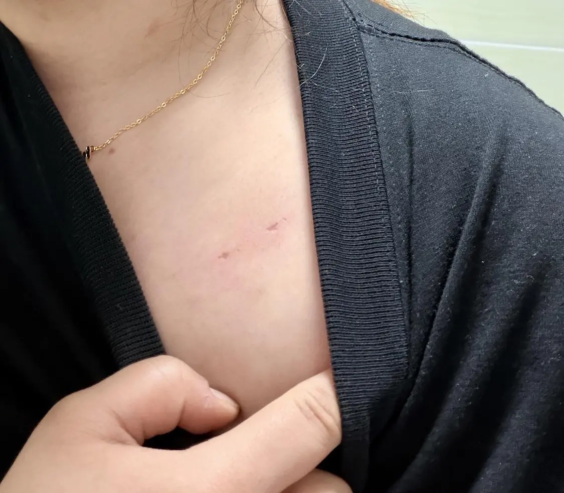 ����Ůʿ���ϵ���Ƥץ�� �ܷ��߹�ͼ