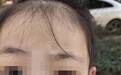 女童眼睛被塞几十片纸，“无法用科学解释”