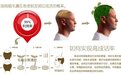上海植发手术的麻醉方法有哪些？